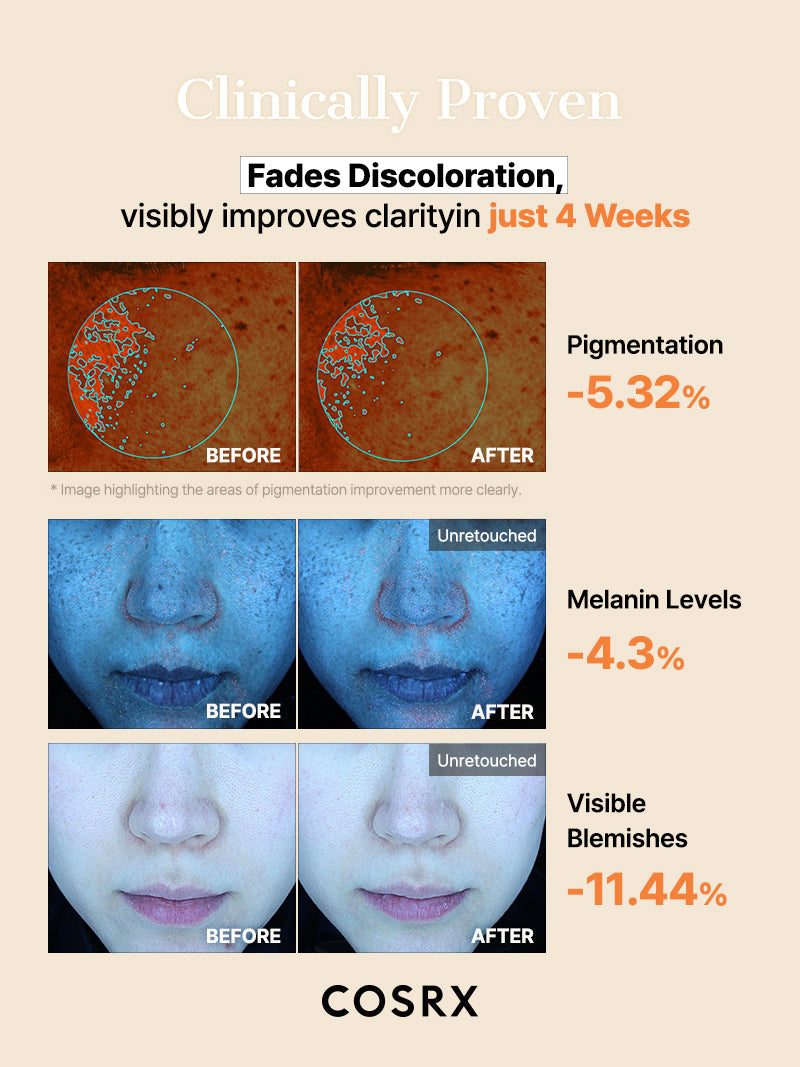 COSRX The Alpha-Arbutin Discoloration Care Hydrogel Mask